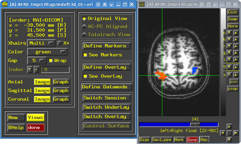 Some creepy brain photos